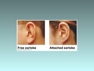 Free earlobe Attached earlobe
 