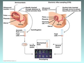 Needle inserted
through abdomen to
extract amniotic fluid
Suction tube inserted
through cervix to extract
tissue from chorionic villi
Ultrasound
monitor
Fetus
Placenta
Chorionic
villi
Uterus
Cervix
Amniocentesis Chorionic villus sampling (CVS)
Ultrasound
monitor
Fetus
Placenta
Uterus
Cervix
Centrifugation
Fetal
cells
Amniotic
fluid
Several
weeks
Biochemical
tests
Karyotyping
Fetal
cells
Several
hours
 