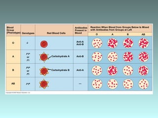 Blood
Group
(Phenotype) Genotypes
O
A
ii
IA
IA
or
IA
i
Red Blood Cells
Carbohydrate A
Antibodies
Present in
Blood
Anti-A
Anti-B
Reaction When Blood from Groups Below Is Mixed
with Antibodies from Groups at Left
Anti-B
O A B AB
B
IB
IB
or
IB
i
Carbohydrate B
AB IA
IB —
Anti-A
 
