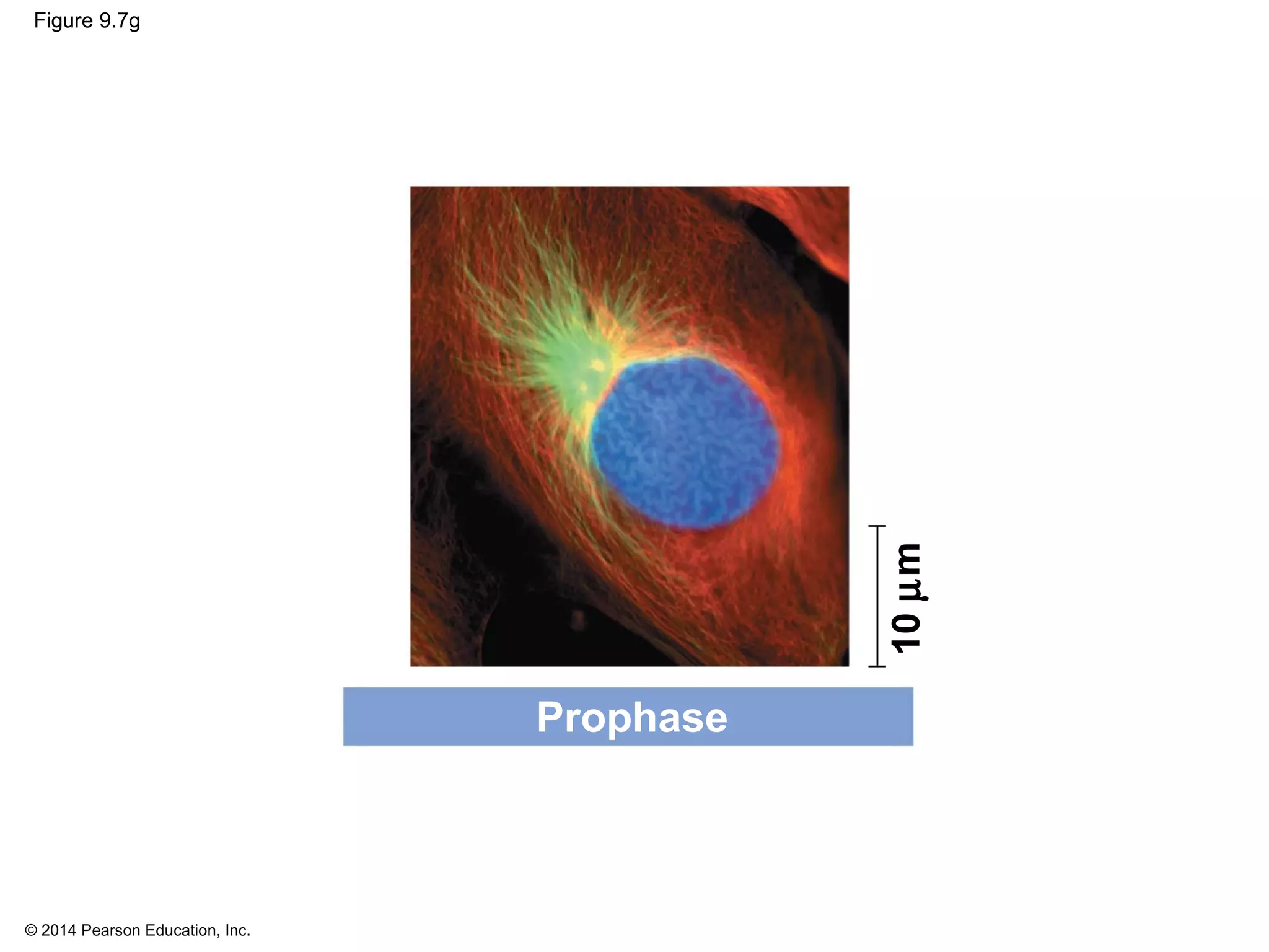 © 2014 Pearson Education, Inc.
Figure 9.7g
Prophase
10µm
 