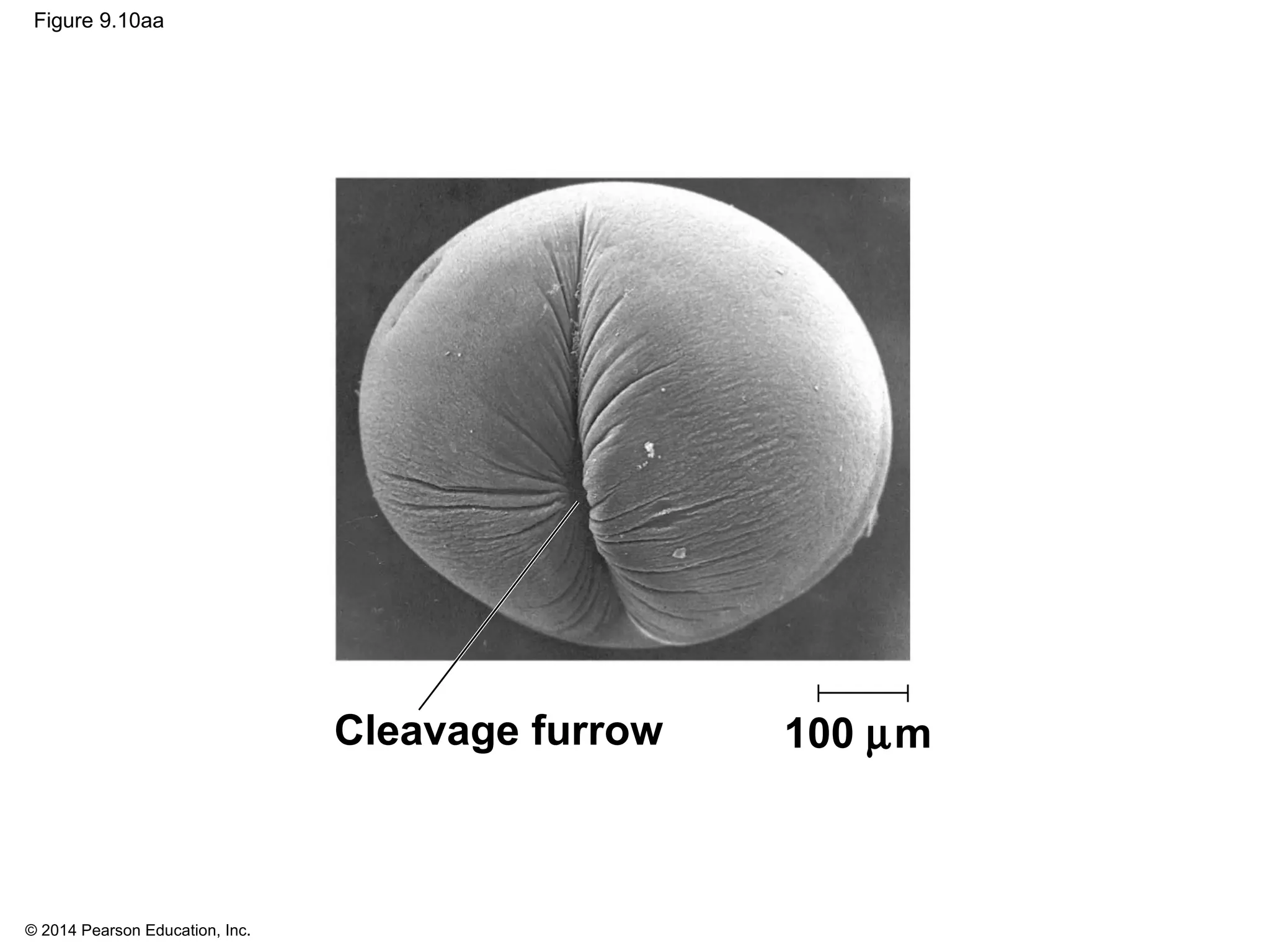 © 2014 Pearson Education, Inc.
Figure 9.10aa
Cleavage furrow 100 µm
 