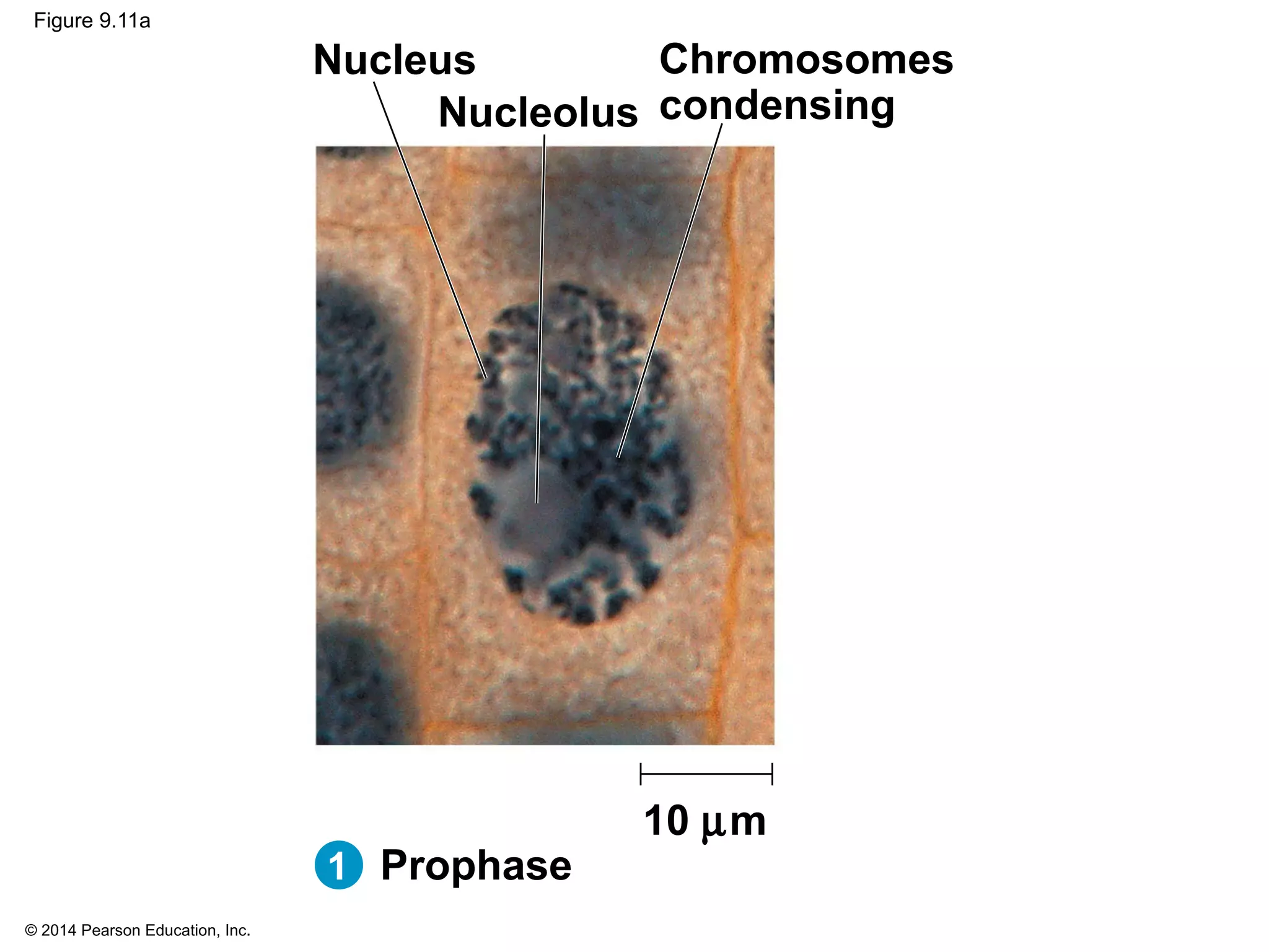 © 2014 Pearson Education, Inc.
Figure 9.11a
10 µm
Nucleus
Nucleolus
Chromosomes
condensing
Prophase1
 