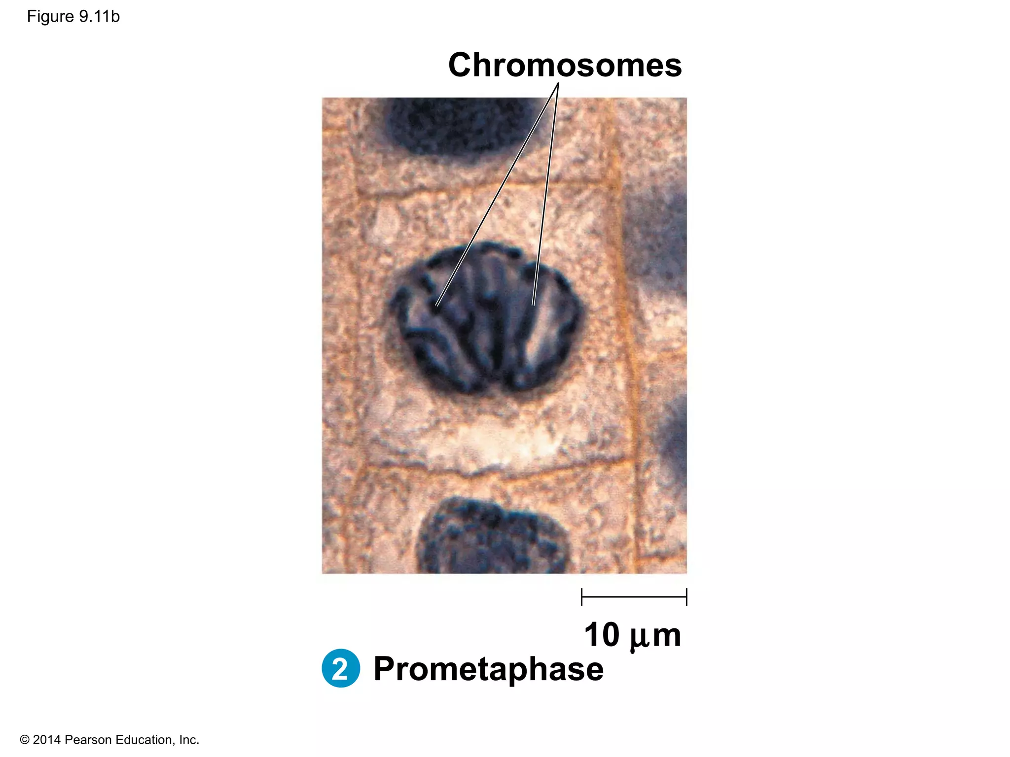 © 2014 Pearson Education, Inc.
Figure 9.11b
10 µm
2 Prometaphase
Chromosomes
 