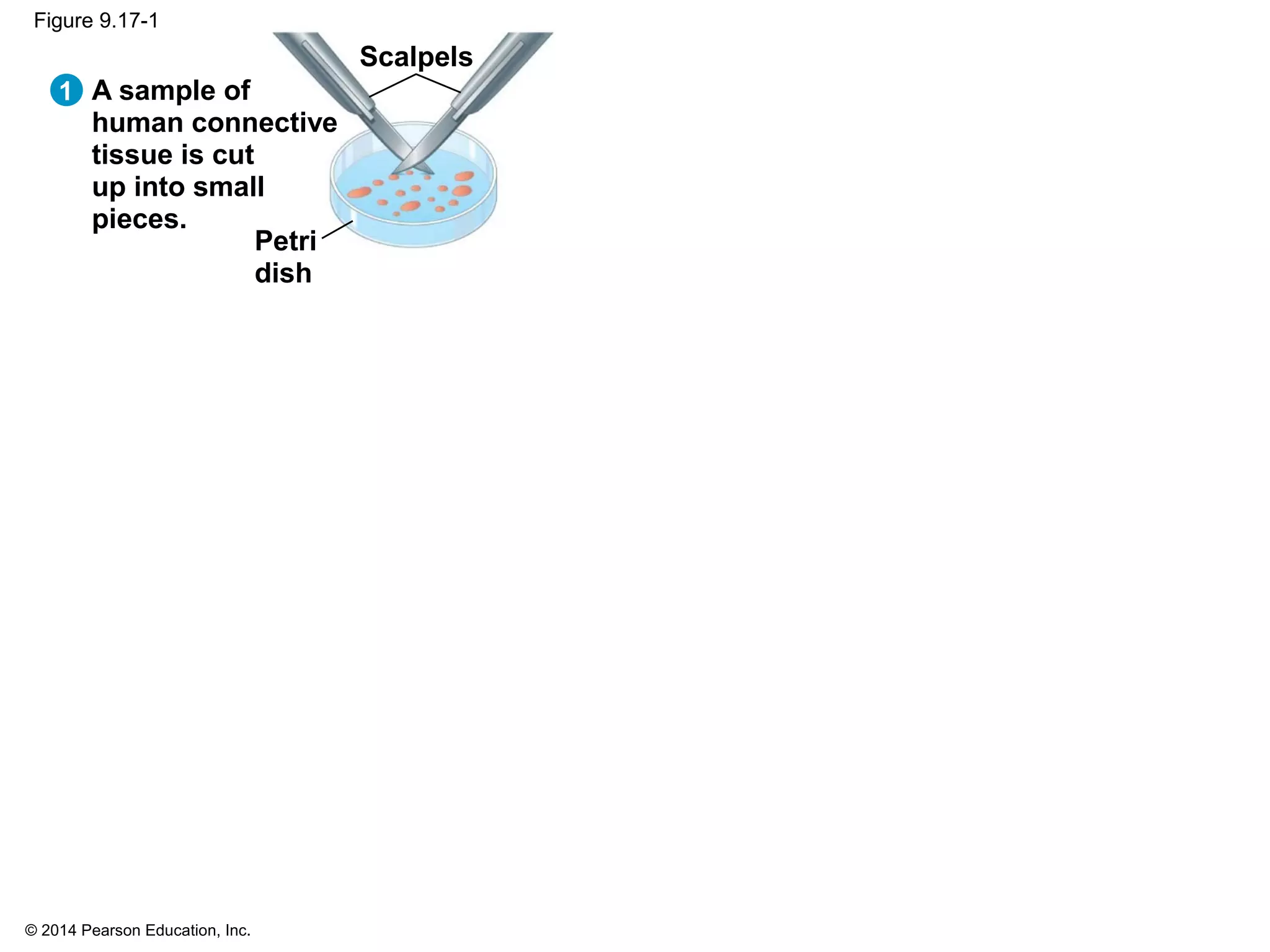 © 2014 Pearson Education, Inc.
Figure 9.17-1
1 A sample of
human connective
tissue is cut
up into small
pieces.
Petri
dish
Scalpels
 