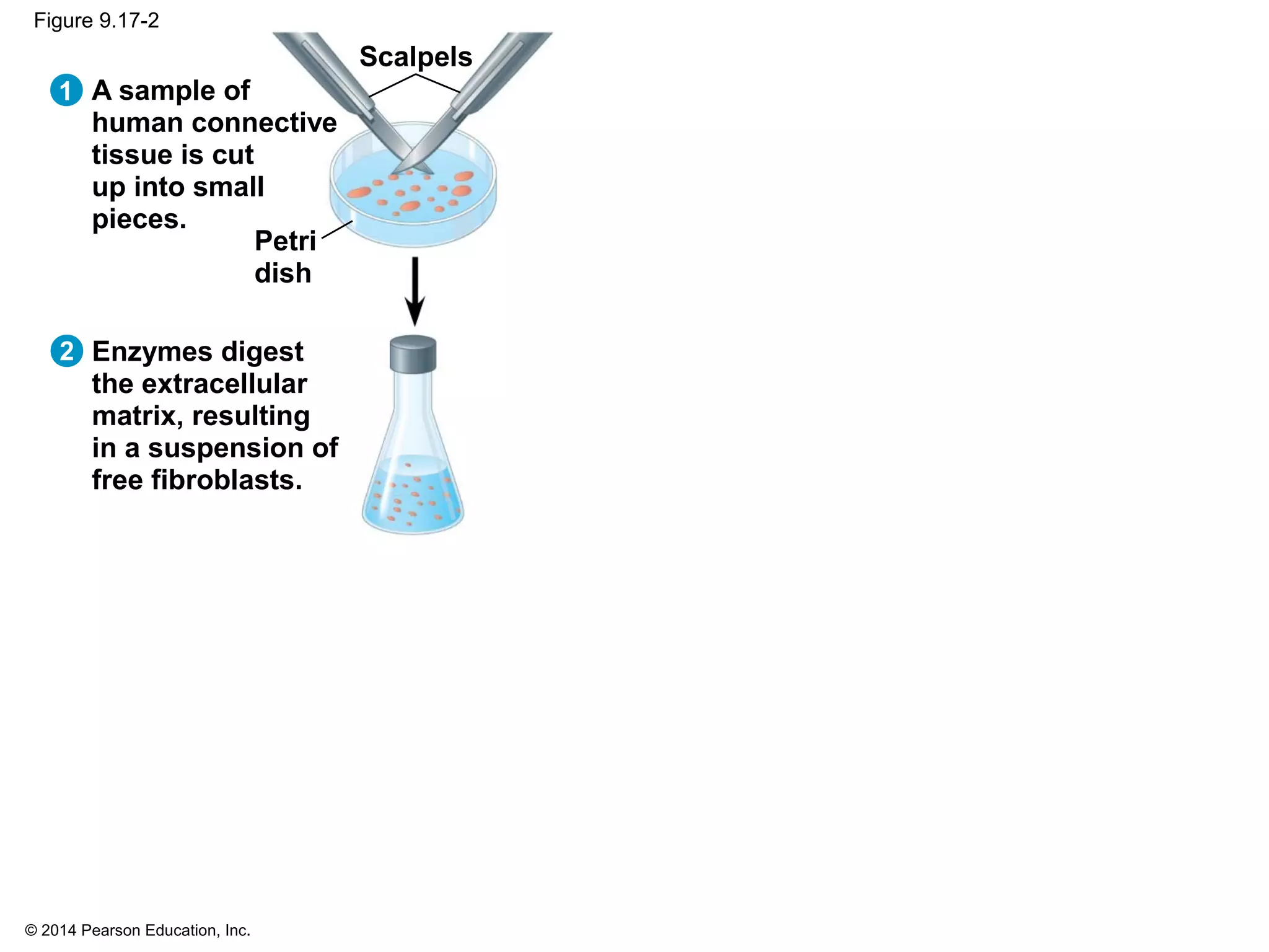 © 2014 Pearson Education, Inc.
Figure 9.17-2
1 A sample of
human connective
tissue is cut
up into small
pieces.
2 Enzymes digest
the extracellular
matrix, resulting
in a suspension of
free fibroblasts.
Petri
dish
Scalpels
 