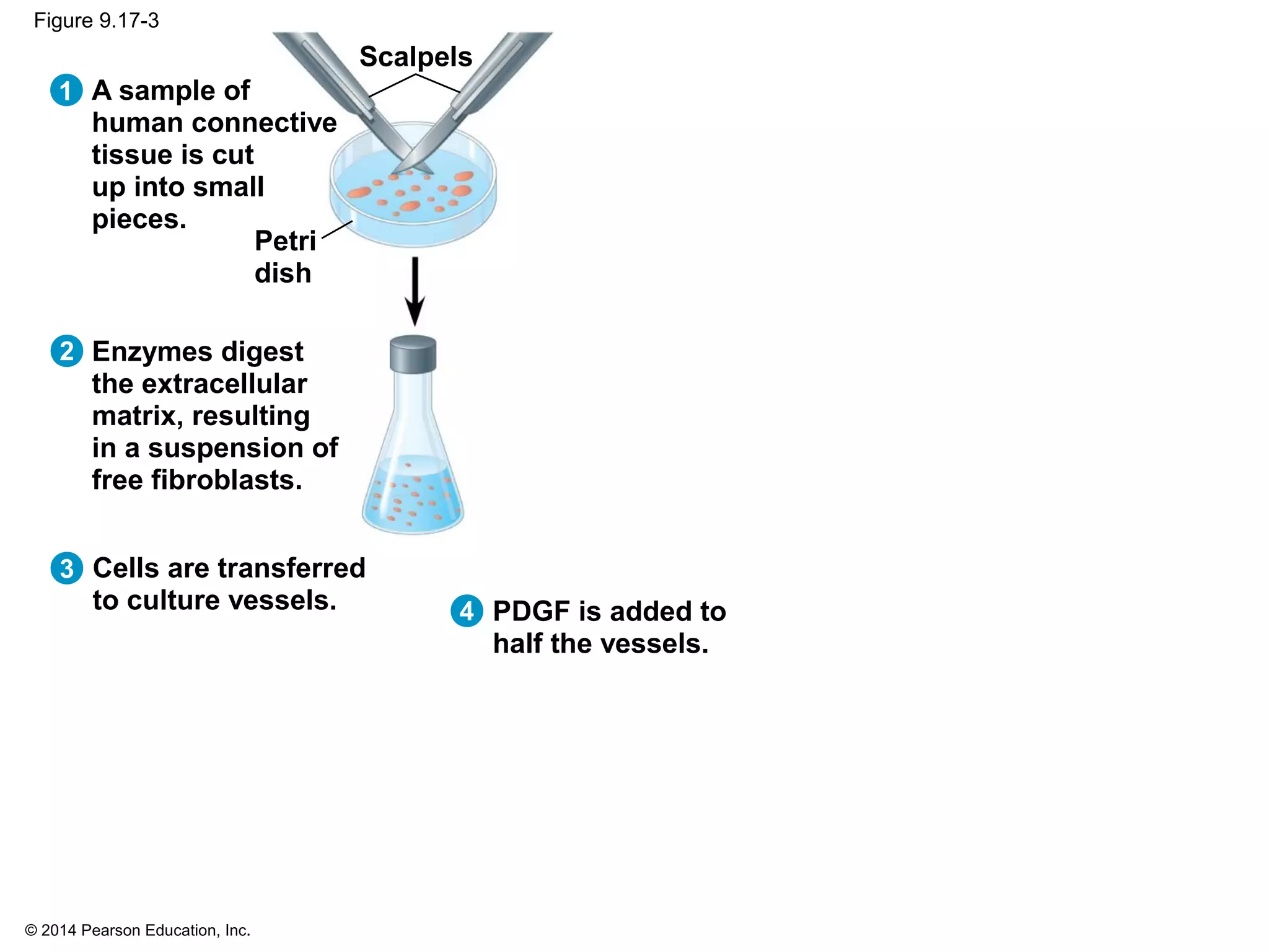 © 2014 Pearson Education, Inc.
Figure 9.17-3
1 A sample of
human connective
tissue is cut
up into small
pieces.
2
3
Enzymes digest
the extracellular
matrix, resulting
in a suspension of
free fibroblasts.
Cells are transferred
to culture vessels.
Petri
dish
Scalpels
4 PDGF is added to
half the vessels.
 