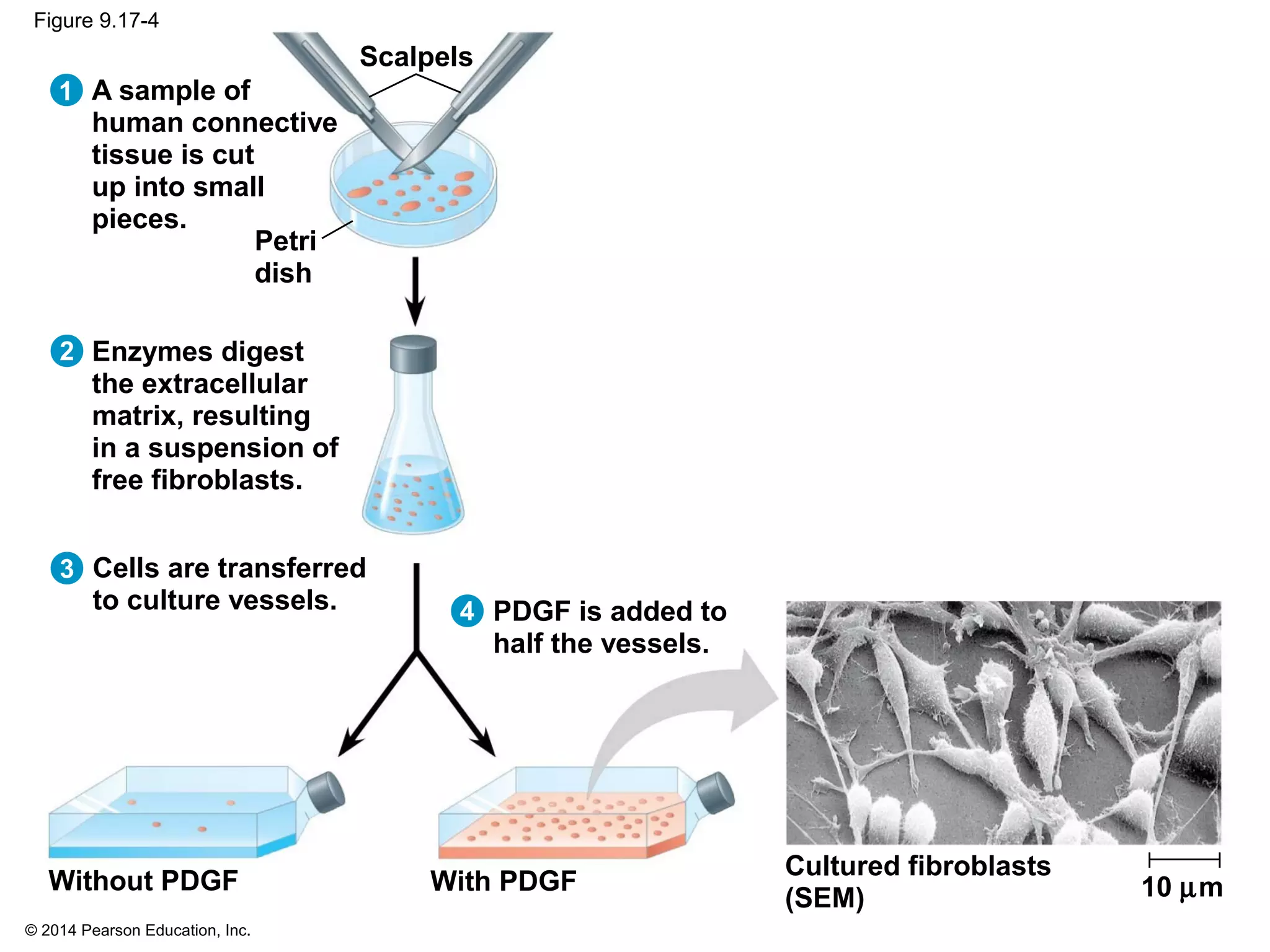 © 2014 Pearson Education, Inc.
Figure 9.17-4
1 A sample of
human connective
tissue is cut
up into small
pieces.
2
3
4
Enzymes digest
the extracellular
matrix, resulting
in a suspension of
free fibroblasts.
Cells are transferred
to culture vessels. PDGF is added to
half the vessels.
Without PDGF With PDGF
Cultured fibroblasts
(SEM) 10 µm
Petri
dish
Scalpels
 