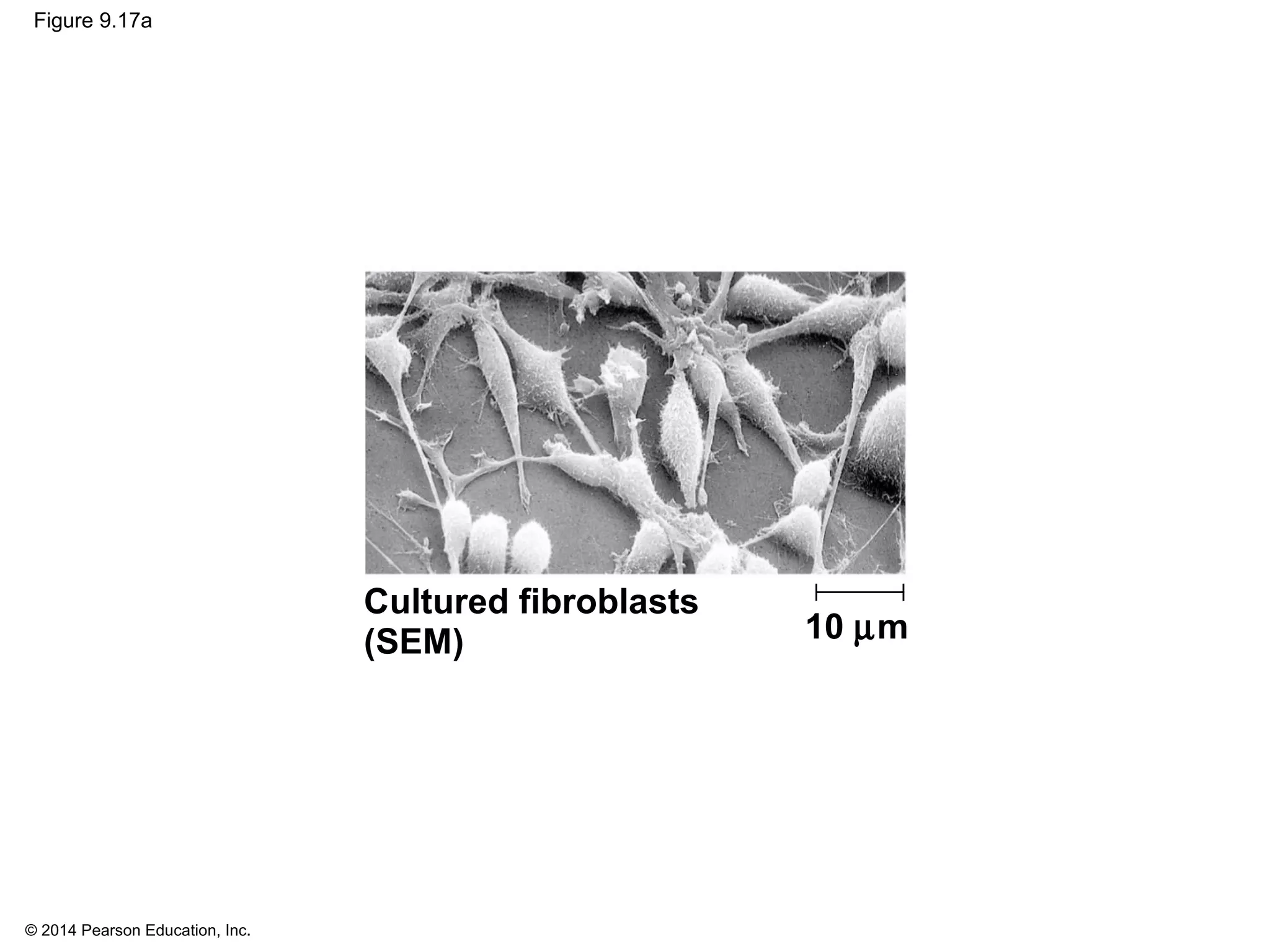 © 2014 Pearson Education, Inc.
Figure 9.17a
Cultured fibroblasts
(SEM) 10 µm
 