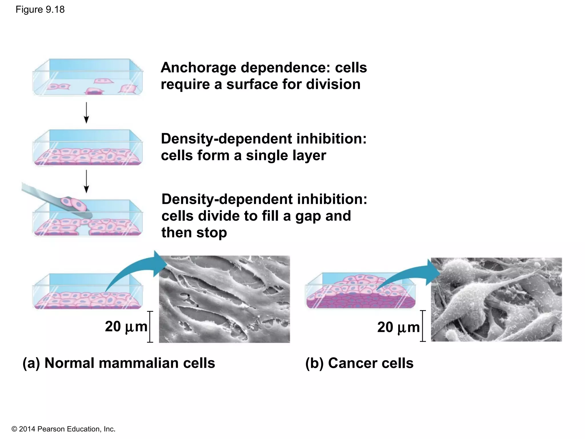 © 2014 Pearson Education, Inc.
Figure 9.18
Anchorage dependence: cells
require a surface for division
20 µm
Density-dependent inhibition:
cells divide to fill a gap and
then stop
Density-dependent inhibition:
cells form a single layer
20 µm
(a) Normal mammalian cells (b) Cancer cells
 