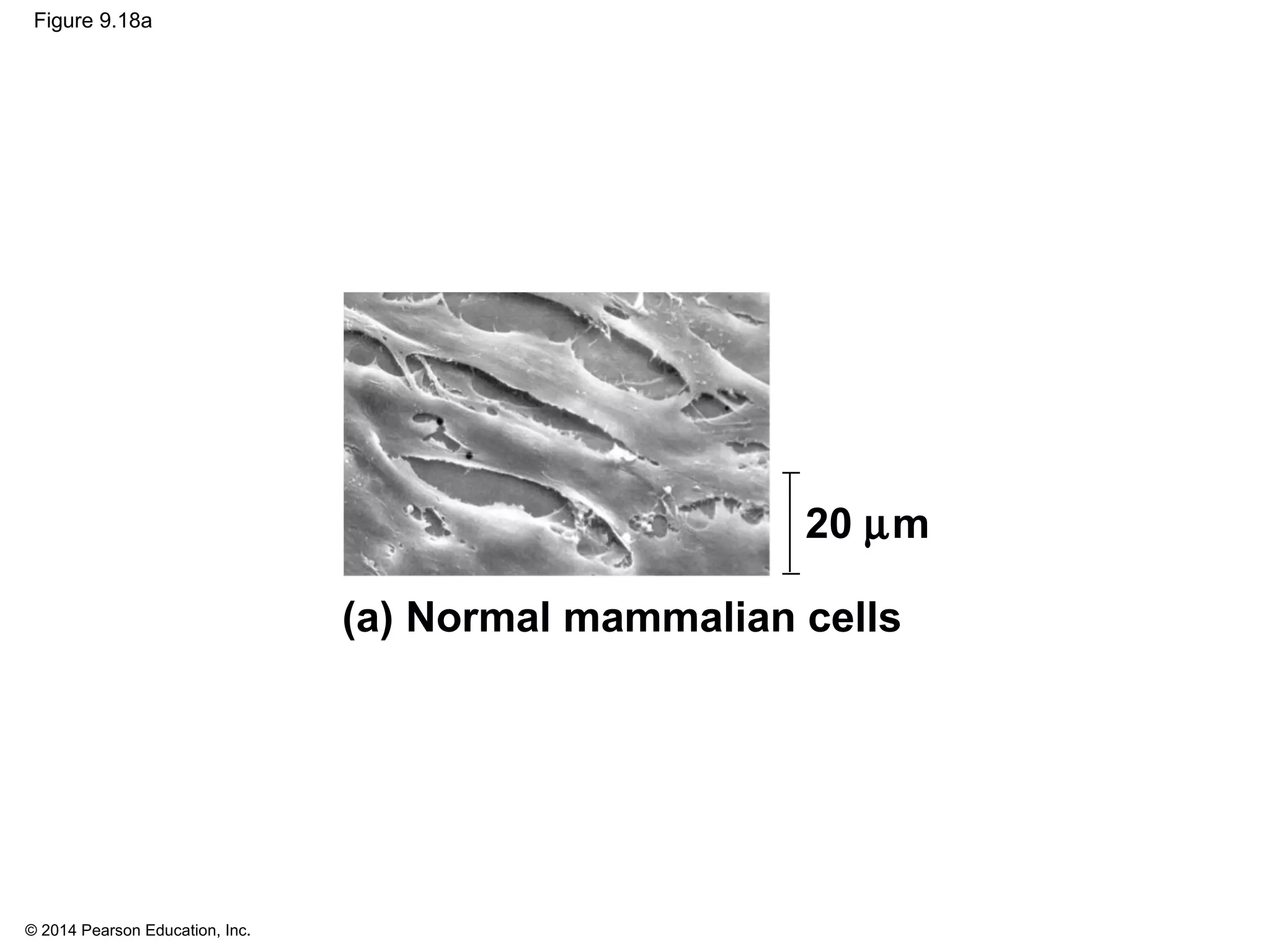 © 2014 Pearson Education, Inc.
Figure 9.18a
20 µm
(a) Normal mammalian cells
 