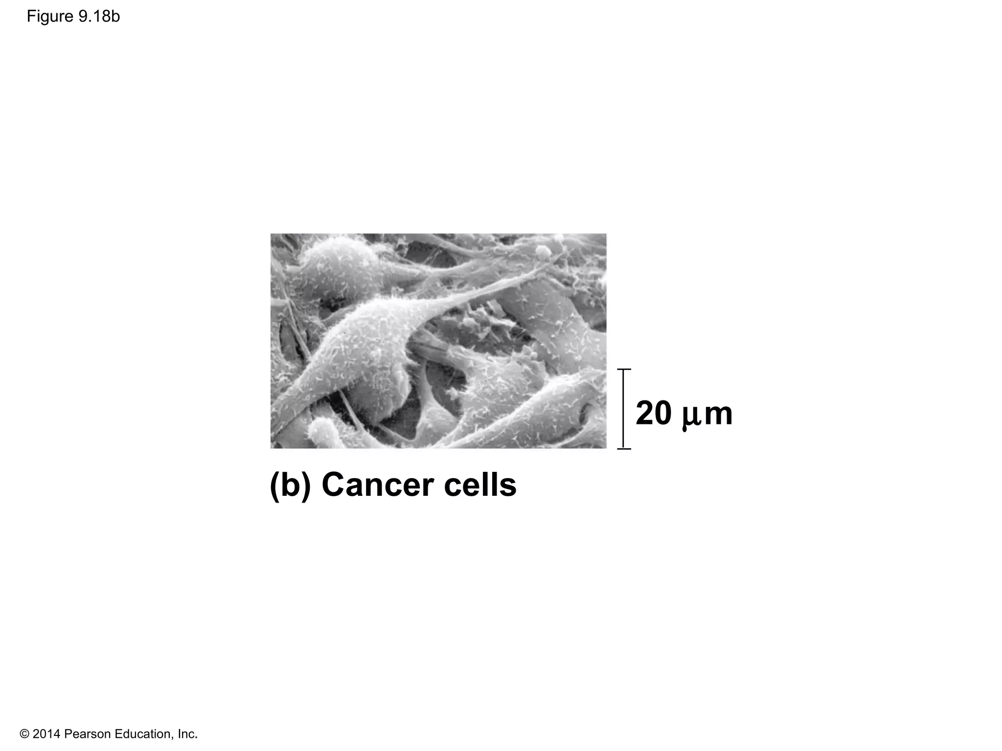 © 2014 Pearson Education, Inc.
Figure 9.18b
(b) Cancer cells
20 µm
 