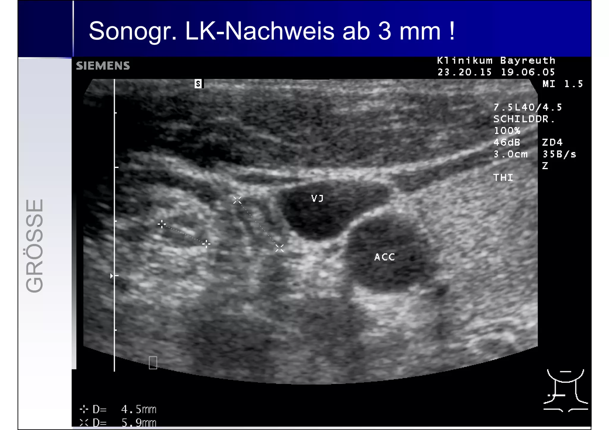Lymphknoten Sonographie In Der Nähe www.slideshare.net
