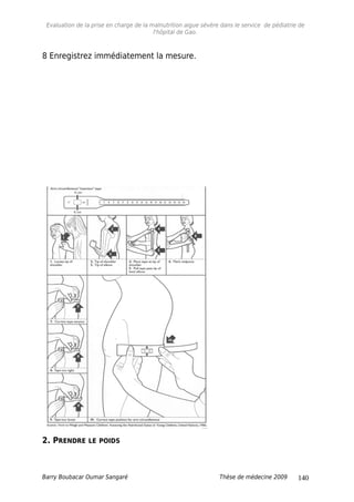 Evaluation de la prise en charge de la malnutrition aigue sévère dans le service de pédiatrie de
l'hôpital de Gao.
8 Enregistrez immédiatement la mesure.
2. PRENDRE LE POIDS
Barry Boubacar Oumar Sangaré Thèse de médecine 2009 140
 