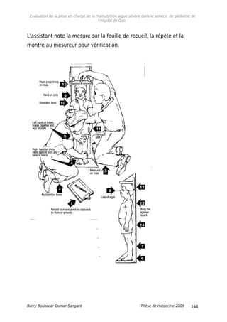 Evaluation de la prise en charge de la malnutrition aigue sévère dans le service de pédiatrie de
l'hôpital de Gao.
L'assistant note la mesure sur la feuille de recueil, la répète et la
montre au mesureur pour vérification.
Barry Boubacar Oumar Sangaré Thèse de médecine 2009 144
 