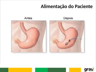 Alimentação do Paciente
 