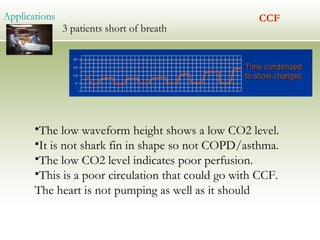 09 pre hospital capnography | PPT