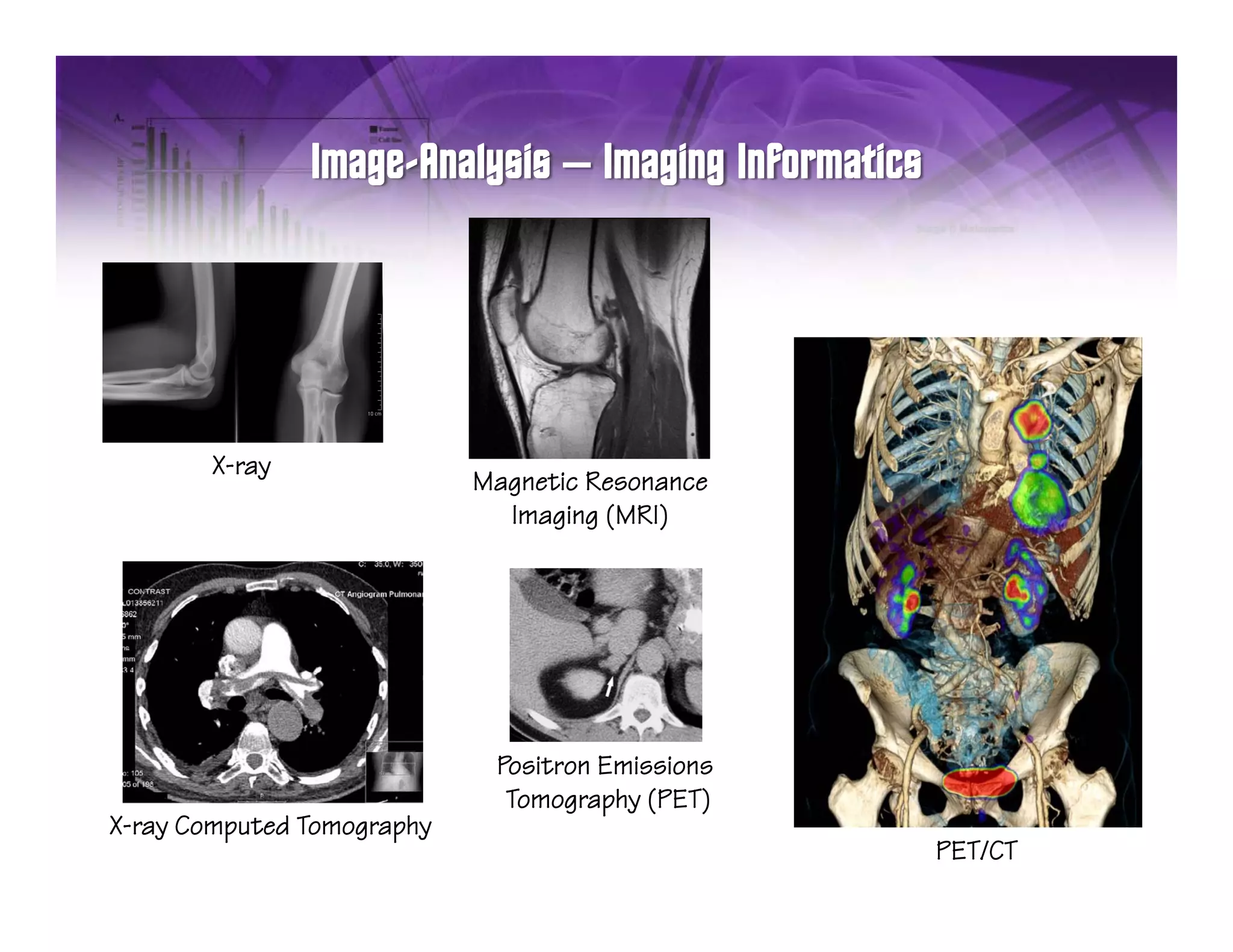 –




       X-ray
                            Magnetic Resonance
                              Imaging (MRI)




                             Positron Emissions
                              Tomography (PET)
X-ray Computed Tomography
                                                  PET/CT
 