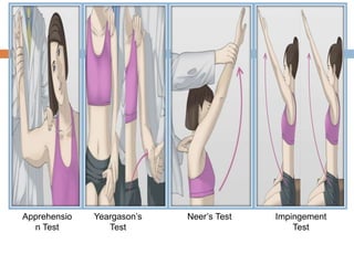 Apprehensio
n Test
Yeargason’s
Test
Neer’s Test Impingement
Test
 