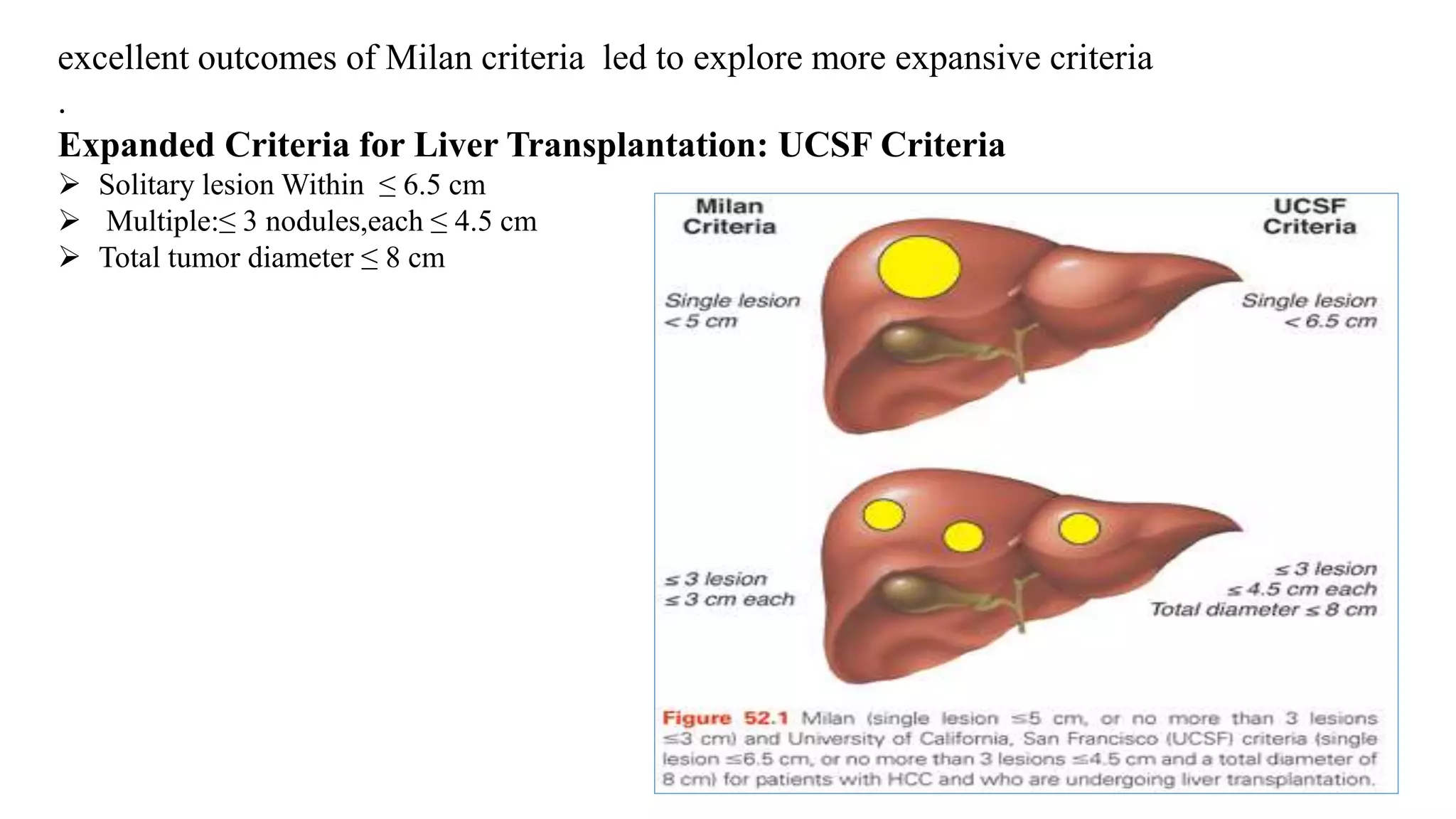 MANAGEMENT OF HEPATOCELLULAR CARCINOMA | PPTX