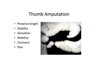 Thumb Amputation
• Preserve length
• Stability
• Sensation
• Mobility
• Cosmesis
• Pain
 