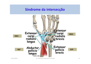 06/12/2015 Dr. José Heitor Machado Fernandes 13
Síndrome da intersecção
ECP
ERCC
ERLC
ALP
 