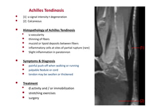• [1] u signal intensity r degeneration
• [2] Calcaneous
• Histopathology of Achilles Tendinosis
• u vascularity
• thinning of fibers
• mucoid or lipoid deposits between fibers
• inflammatory cells at sites of partial rupture (rare)
• Slight inflammation in paratennon
• Symptoms & Diagnosis
• painful push-off when walking or running
• palpable Nodule or cord
• tendon may be swollen or thickened
• Treatment
• d activity and / or immobilization
• stretching exercises
• surgery
Achilles Tendinosis
 