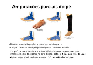 • Lisfranc:
•Chopart: caracteriza-se pela preservação do calcâneo e tornozelo.
amputação ao nível proximal dos metatarseanos.
•Pirogoff: amputação feita acima dos maléolos do tornozelo, com enxerto da
extremidade distal do calcâneo na parte distal do côto.
•Syme: amputação à nível do tornozelo.
Amputações parciais do pé
(3-4 cms até o nível do solo)
(4-7 cms até o nível do solo)
 