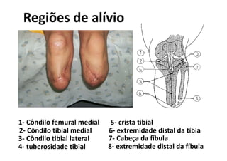Regiões de alívio
1- Côndilo femural medial
2- Côndilo tibial medial
3- Côndilo tibial lateral
4- tuberosidade tibial
5- crista tibial
6- extremidade distal da tíbia
7- Cabeça da fíbula
8- extremidade distal da fíbula
 