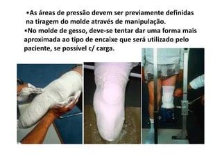 •No molde de gesso, deve-se tentar dar uma forma mais
aproximada ao tipo de encaixe que será utilizado pelo
paciente, se possível c/ carga.
•As áreas de pressão devem ser previamente definidas
na tiragem do molde através de manipulação.
 