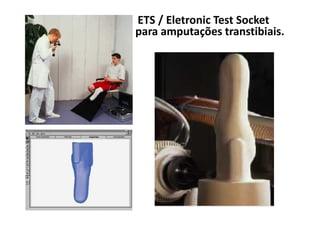 ETS / Eletronic Test Socket
para amputações transtibiais.
 