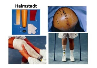 Figura
Halmstadt
 