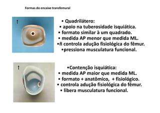 Formas do encaixe transfemural
• Quadrilátero:
• apoio na tuberosidade isquiática.
• formato similar à um quadrado.
• medida AP menor que medida ML.
•Contenção isquiática:
• medida AP maior que medida ML.
• formato + anatômico, + fisiológico.
• controla adução fisiológica do fêmur.
•ñ controla adução fisiológica do fêmur.
• libera musculatura funcional.
•pressiona musculatura funcional.
 