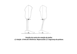 Posição do centro de rotação do joelho
c/ relação à linha de referência. Repercussão s/ a segurança da prótese.
 