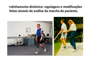 Figura
•alinhamento dinâmico: regulagens e modificações
feitas através de análise da marcha do paciente.
 