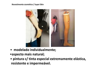 Revestimento cosmético / Super Skin
•aspecto mais natural;
• modelado individualmente;
• pintura c/ tinta especial extremamente elástica,
resistente e impermeável.
 