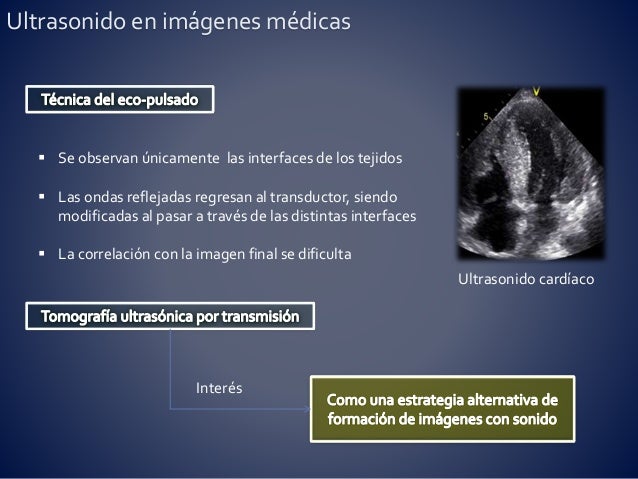 Imagenes Medicas Ultrasonido | dise 241 o construcci 243 n y puesta a punto de un tom 243 grafo por Imagenes Medicas Ultrasonido | dise 241 o construcci 243 n y puesta a punto de un tom 243 grafo por