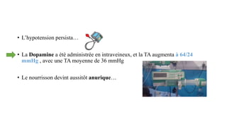 • L’hypotension persista…
• La Dopamine a été administrée en intraveineux, et la TA augmenta à 64/24
mmHg , avec une TA moyenne de 36 mmHg
• Le nourrisson devint aussitôt anurique…
 