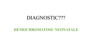 DIAGNOSTIC???
HEMOCHROMATOSE NEONATALE
 