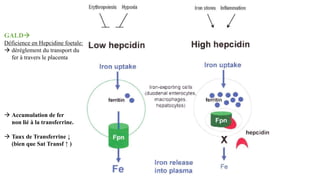 GALD
Déficience en Hepcidine foetale:
 dérèglement du transport du
fer à travers le placenta
 Accumulation de fer
non lié à la transferrine.
 Taux de Transferrine ↓
(bien que Sat Transf ↑ )
 