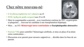 Chez nôtre nouveau-né:
• L'érythrocytaphérèse (x2 volumes) au J3
• IVIG 1g/Kg de poids corporel aux J3 et J8
• Mais la coagulopathie a persisté…avec transfusion continue de PFC, cryprécipités
et plaquettes… nouveau-né candidate à une transplantation hépatique.
• Mais… au J15: Hémorragie intra-ventriculaire et Encéphalopathie obstructive
• Facteur VIIa pour contrôler l’hémorragie cérébrale, et mise en place d’un drain
extra-ventriculaire…
• Discussion avec parents pour mesures supportives… décédée dans les bras de ses
parents
 