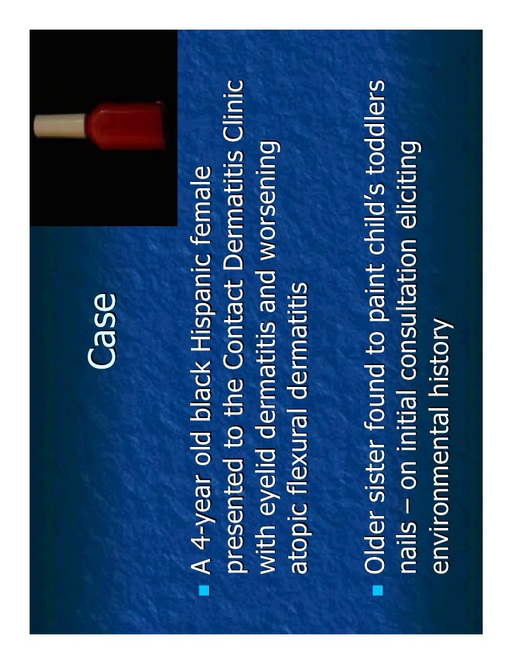 Tosylamide/formaldehyde resin a consideration in the atopic toddler
