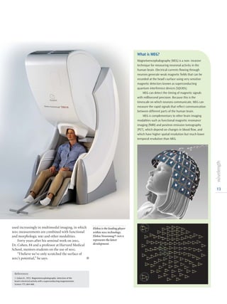 13
used increasingly in multimodal imaging, in which
meg measurements are combined with functional
and morphologic mri and other modalities.
Forty years after his seminal work on meg,
Dr. Cohen, 84 and a professor at Harvard Medical
School, mentors students on the use of meg.
“I believe we’ve only scratched the surface of
meg’s potential,” he says.  l
References
1. Cohen D., 1972. Magnetoencephalography: detection of the
brain’s electrical activity with a superconducting magnetometer.
Science 175, 664-666.
What is MEG?
Magnetoencephalography (MEG) is a non- invasive
technique for measuring neuronal activity in the
human brain. Electrical currents flowing through
neurons generate weak magnetic fields that can be
recorded at the head’s surface using very sensitive
magnetic detectors known as superconducting
quantum interference devices (SQUIDs).
MEG can detect the timing of magnetic signals
with millisecond precision. Because this is the
timescale on which neurons communicate, MEG can
measure the rapid signals that reflect communication
between different parts of the human brain.
MEG is complementary to other brain imaging
modalities such as functional magnetic resonance
imaging (fMRI) and positron emission tomography
(PET), which depend on changes in blood flow, and
which have higher spatial resolution but much lower
temporal resolution than MEG.
Elekta is the leading player
within meg technology.
Elekta Neuromag® triux
represents the latest
development.
 