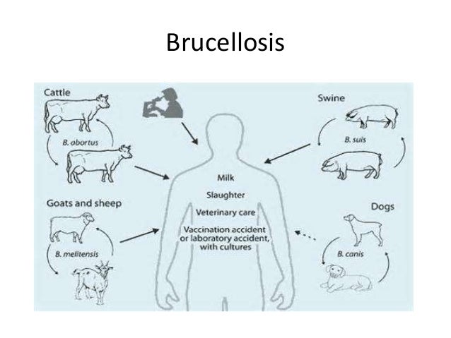 brucellosis Brucellosis