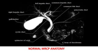 NORMAL MRCP ANATOMY
 