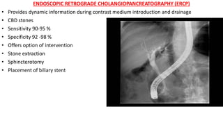 ENDOSCOPIC RETROGRADE CHOLANGIOPANCREATOGRAPHY (ERCP)
• Provides dynamic information during contrast medium introduction and drainage
• CBD stones
• Sensitivity 90-95 %
• Specificity 92 -98 %
• Offers option of intervention
• Stone extraction
• Sphincterotomy
• Placement of biliary stent
 