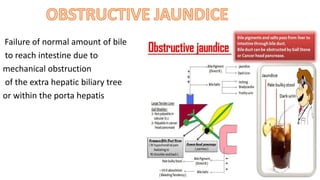 Failure of normal amount of bile
to reach intestine due to
mechanical obstruction
of the extra hepatic biliary tree
or within the porta hepatis
 