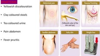 SYMPTOMS
• Yellowish discolouration
• Clay coloured stools
• Tea coloured urine
• Pain abdomen
• Fever pruritis
 