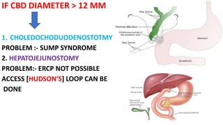 IF CBD DIAMETER > 12 MM
1. CHOLEDOCHODUODENOSTOTMY
PROBLEM :- SUMP SYNDROME
2. HEPATOJEJUNOSTOMY
PROBLEM:- ERCP NOT POSSIBLE
ACCESS [HUDSON’S] LOOP CAN BE
DONE
 