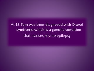At 15 Tom was then diagnosed with Dravet
syndrome which is a genetic condition
that causes severe epilepsy
 