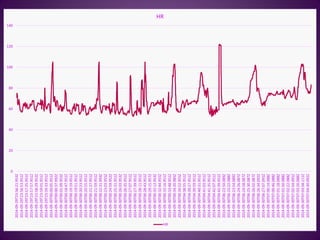 0
20
40
60
80
100
120
140
2014-09-29T23:56:21.953Z
2014-09-29T23:56:53.951Z
2014-09-29T23:57:25.951Z
2014-09-29T23:57:57.951Z
2014-09-29T23:58:29.952Z
2014-09-29T23:59:01.951Z
2014-09-29T23:59:33.951Z
2014-09-30T00:00:05.951Z
2014-09-30T00:00:37.992Z
2014-09-30T00:01:09.955Z
2014-09-30T00:18:47.951Z
2014-09-30T00:19:19.951Z
2014-09-30T00:19:51.951Z
2014-09-30T00:20:23.951Z
2014-09-30T00:20:55.951Z
2014-09-30T00:21:27.951Z
2014-09-30T00:21:59.951Z
2014-09-30T00:22:31.993Z
2014-09-30T00:23:03.955Z
2014-09-30T00:24:59.952Z
2014-09-30T00:25:31.951Z
2014-09-30T00:26:03.953Z
2014-09-30T00:26:35.951Z
2014-09-30T00:27:07.951Z
2014-09-30T00:27:39.951Z
2014-09-30T00:28:11.951Z
2014-09-30T00:28:43.951Z
2014-09-30T00:29:15.957Z
2014-09-30T00:32:12.953Z
2014-09-30T00:32:44.955Z
2014-09-30T00:33:16.951Z
2014-09-30T00:33:48.951Z
2014-09-30T00:34:20.985Z
2014-09-30T00:34:52.955Z
2014-09-30T04:38:55.951Z
2014-09-30T04:39:27.951Z
2014-09-30T04:39:59.951Z
2014-09-30T04:40:31.951Z
2014-09-30T04:41:03.951Z
2014-09-30T04:41:35.951Z
2014-09-30T04:42:07.951Z
2014-09-30T04:42:39.951Z
2014-09-30T06:22:50.089Z
2014-09-30T06:23:22.088Z
2014-09-30T06:23:54.089Z
2014-09-30T06:24:26.087Z
2014-09-30T06:24:58.087Z
2014-09-30T06:25:30.087Z
2014-09-30T06:26:02.087Z
2014-09-30T06:26:34.092Z
2014-09-30T06:27:07.091Z
2014-09-30T07:00:14.088Z
2014-09-30T07:00:46.088Z
2014-09-30T07:01:18.088Z
2014-09-30T07:01:50.088Z
2014-09-30T07:02:22.088Z
2014-09-30T07:02:54.091Z
2014-09-30T07:03:26.088Z
2014-09-30T07:03:58.111Z
2014-09-30T07:04:30.092Z
HR
HR
 